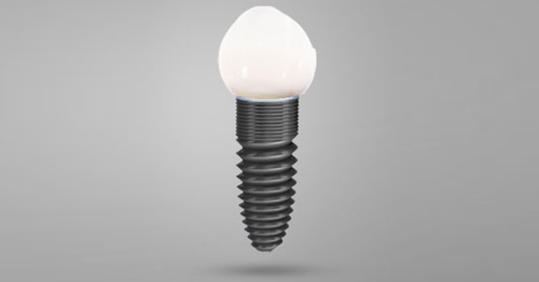 Top Dental Implant Specialist for Rancho Mirage and Surrounding Areas Top Dental Implant Specialist for Rancho Mirage and Surrounding Areas