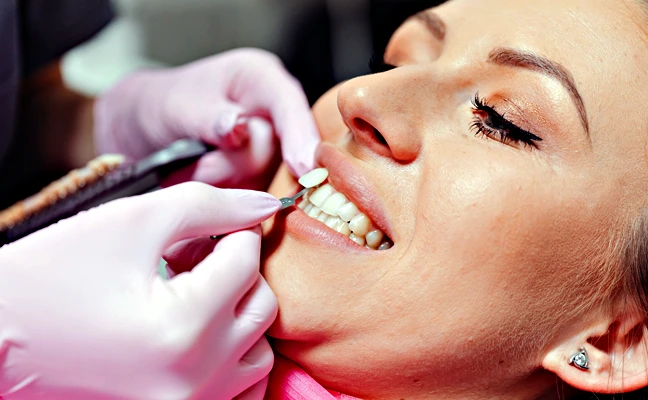 Dental veneers Dental veneers Rancho Mirage, Palm Desert, Palm Spring, Coachella Valley, Cathedral City, La Quinta, Desert Hot Springs, Yucca Valley, Indian Wells
