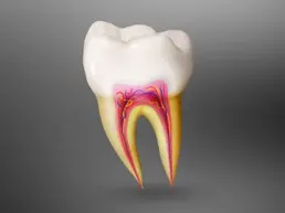 Root Canal Treatment Root Canal Treatment