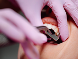Oral Surgery Oral Surgery