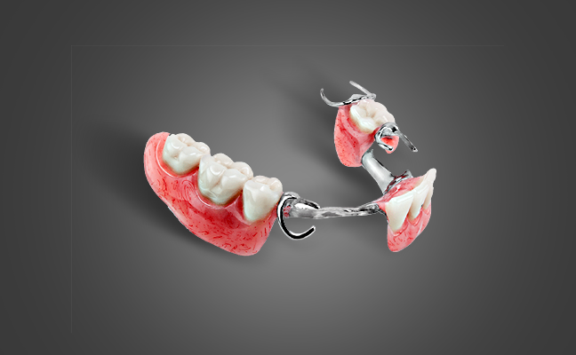 Partial Dentures Rancho Mirage, Palm Desert, Palm Spring, Coachella Valley, Cathedral City, La Quinta, Desert Hot Springs, Yucca Valley, Indian Wells