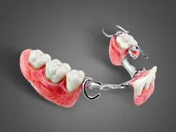 Complete and Partial Dentures Complete and Partial Dentures Rancho Mirage, Palm Desert, Palm Spring, Coachella Valley, Cathedral City, La Quinta, Desert Hot Springs, Yucca Valley, Indian Wells