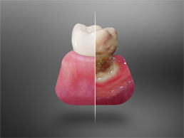 Periodontal Care Periodontal Care